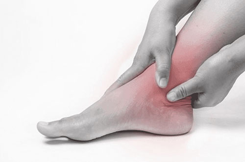 ankle sprains